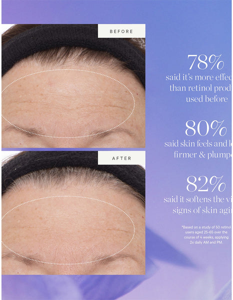 KORA PLANT STEM CELL RETINOL ALTERNATIVE SERUM 30ML