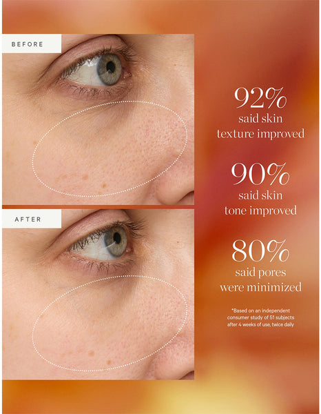 KORA Turmeric Glow Drops Niacinamide Alternative Serum